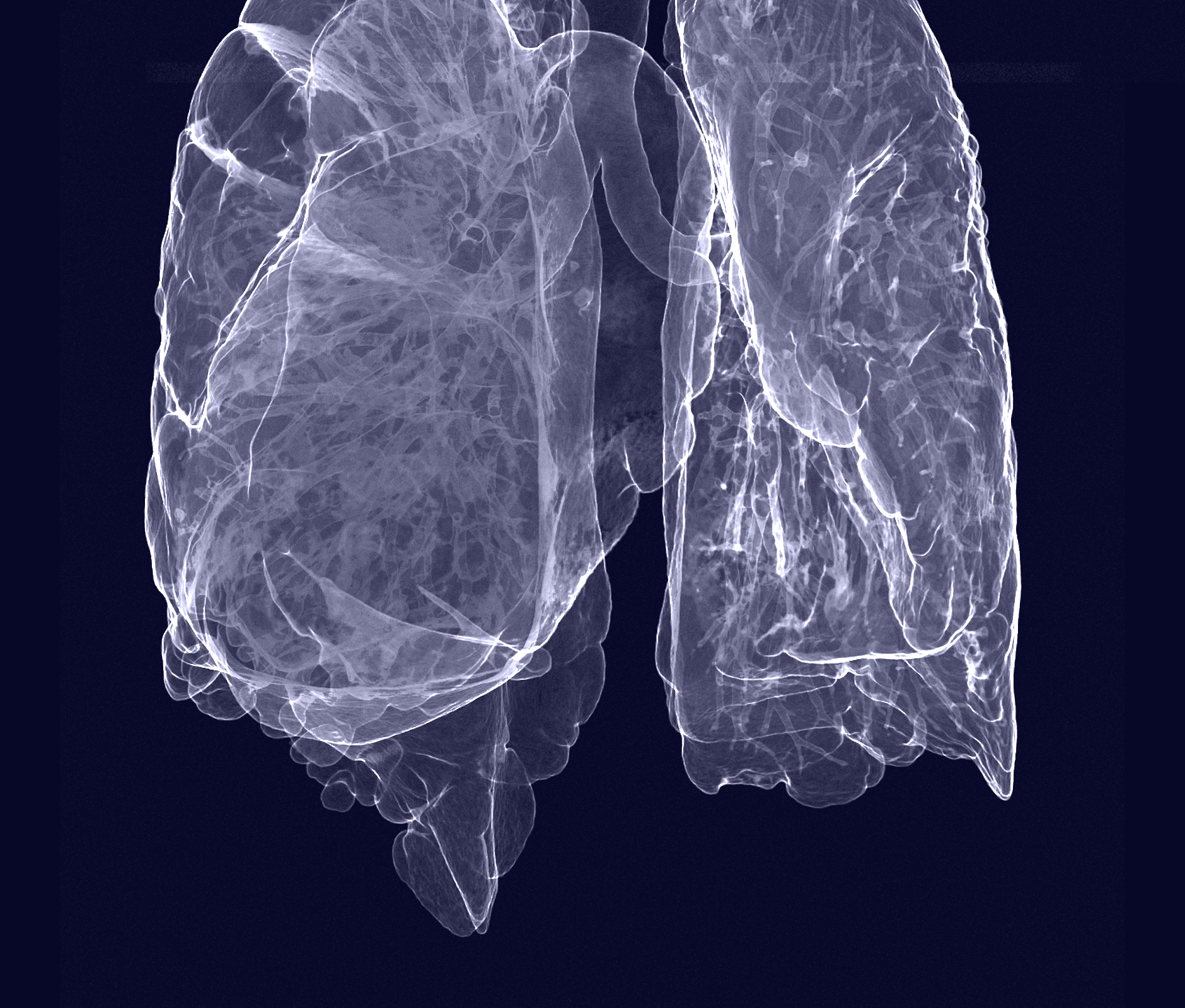 Detailed lung scan
