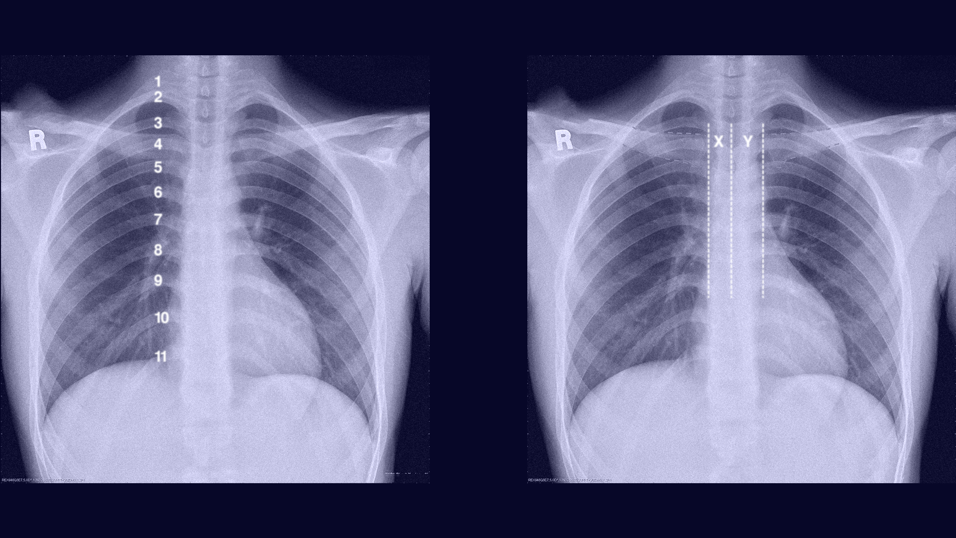 Chest and spine radiography scan for Tec Salud Marketing Campaign