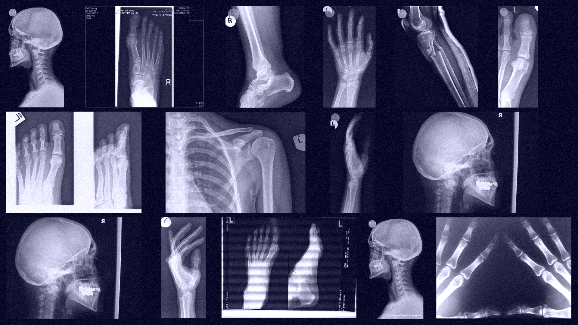 Multiple hand, skull, & feet radiography scans used in Tec Salud Medicine school marketing campaign 
