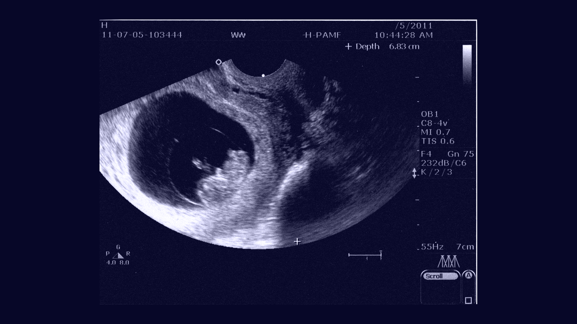Blue ultrasound scan 