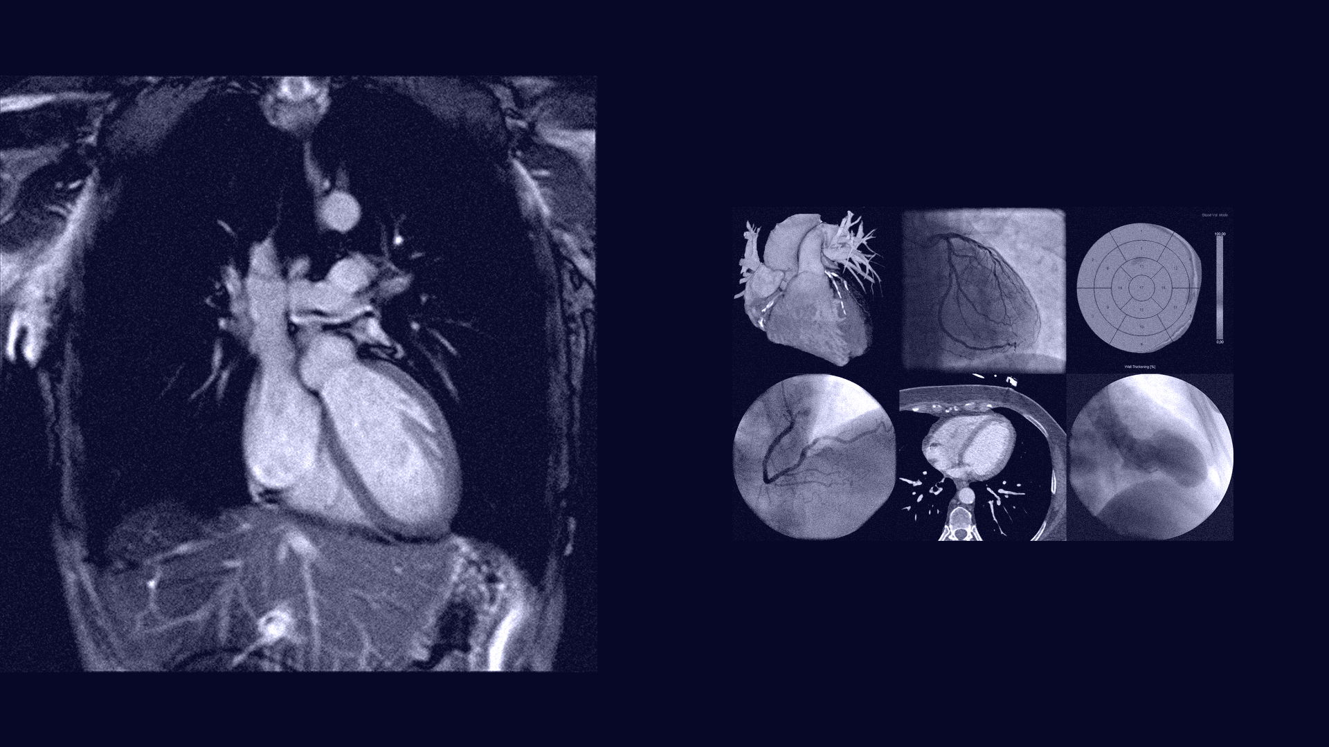 Detailed radiography scan of the heart and different organs 