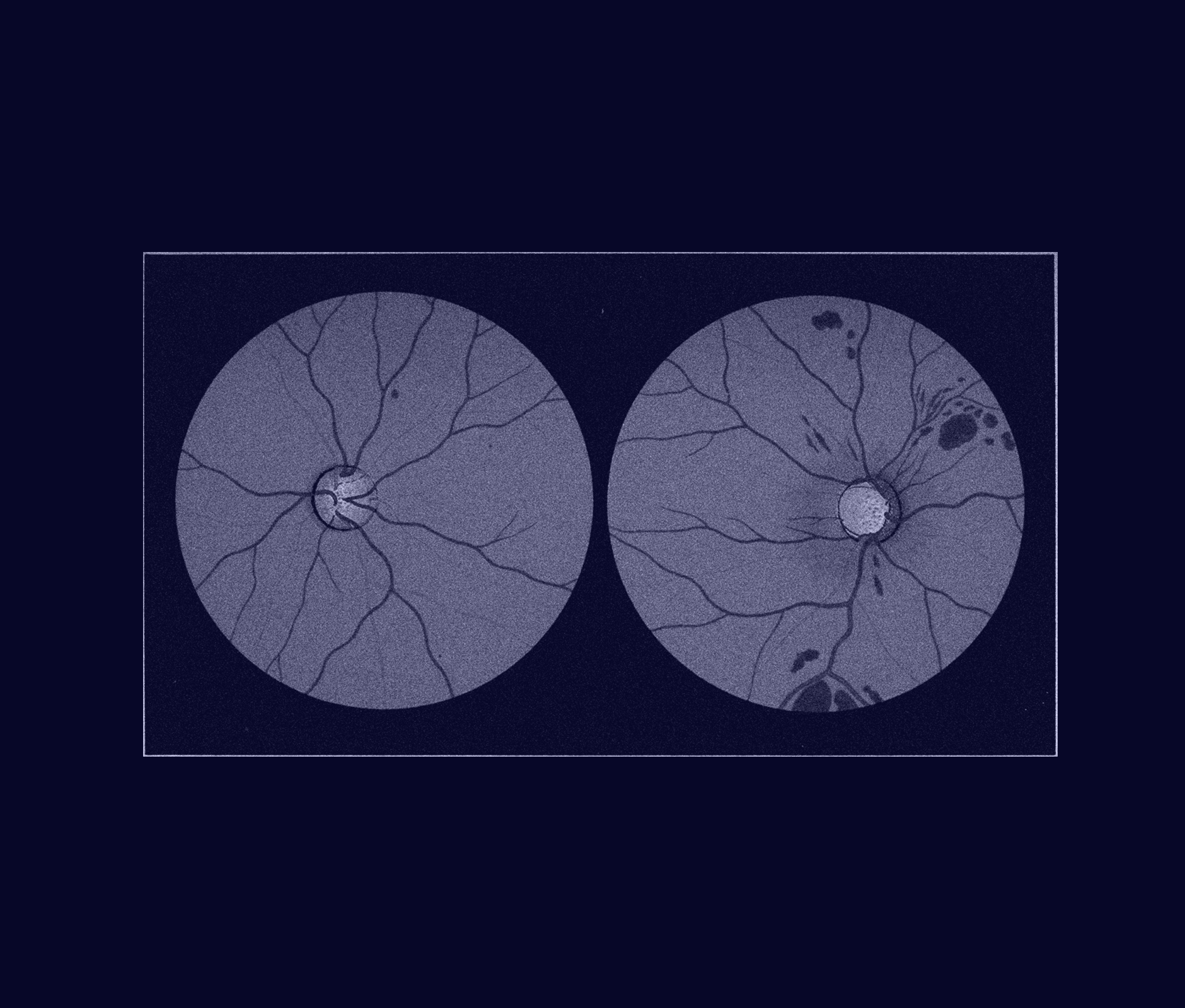 Blue eye retina scan