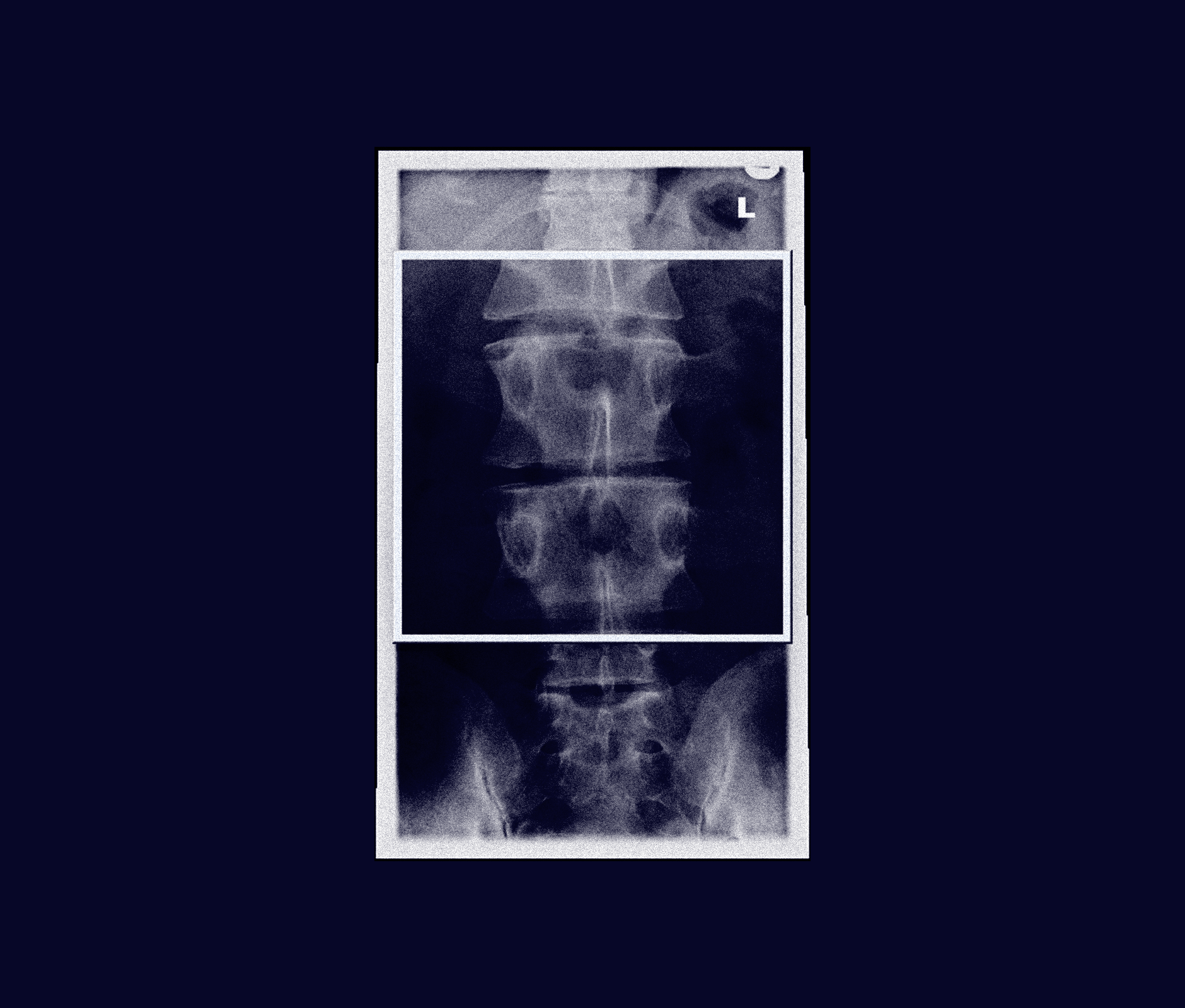 Radiography scan graphic composition used in Tec salud medicine school publicity campaign