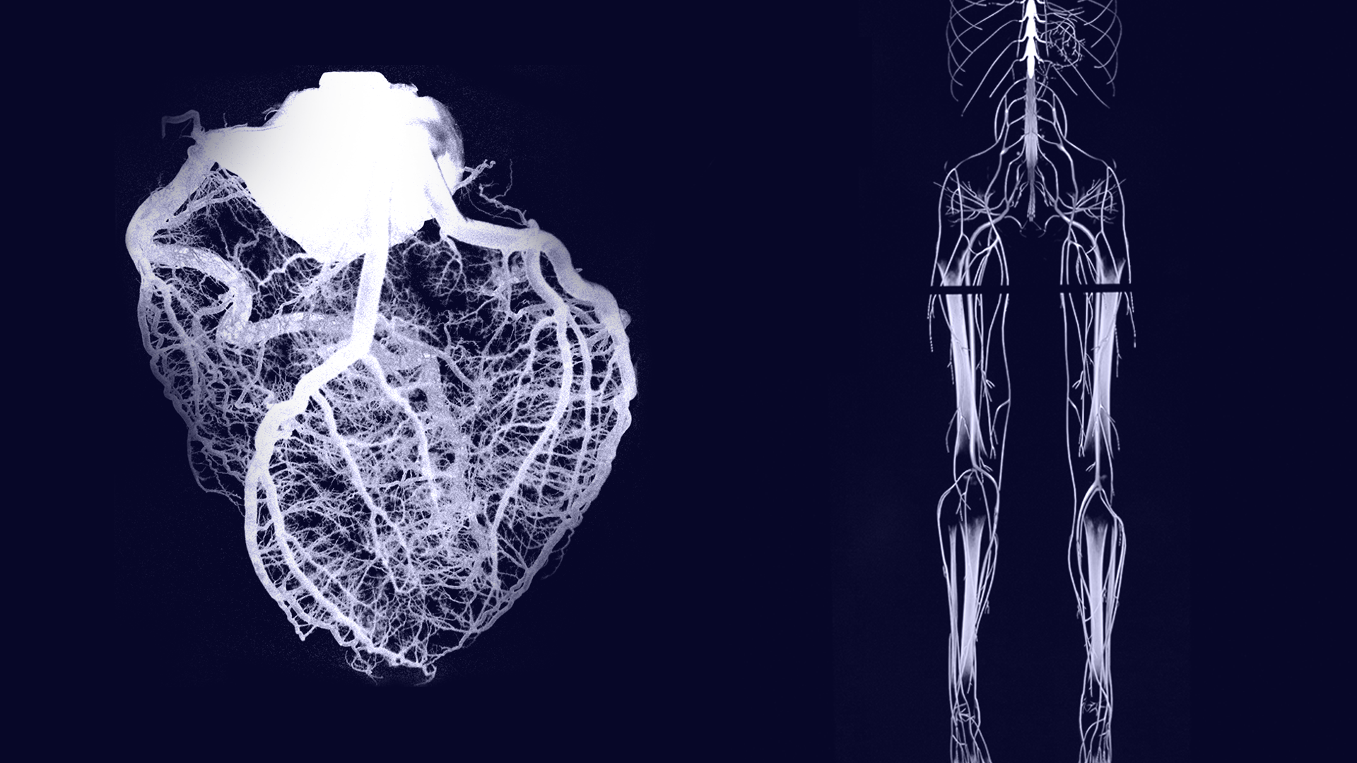 Scan of the major veins and arteries in the body and heart used in Tec salud marketing campaign