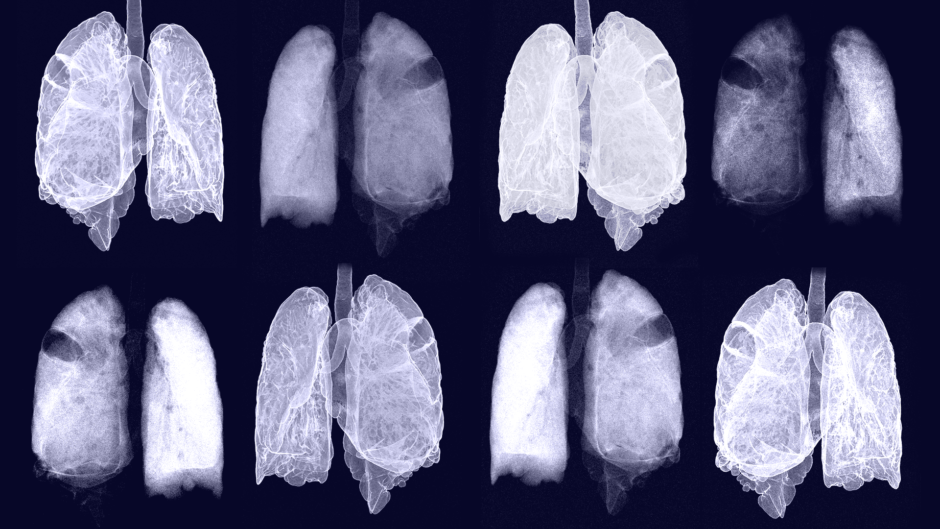 Various lung scans used in Tec Salud marketing campaign